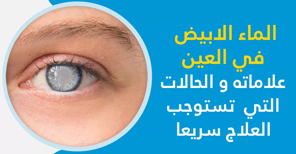 الماء الابيض في العين علاماته و الحالات التي تستوجب العلاج سريعا